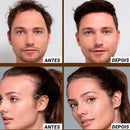 MinoxiHair Diminui Queda em 95% Aumenta Crescimento 20x - Compre 1 Leve 2