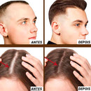 MinoxiHair Diminui Queda em 95% Aumenta Crescimento 20x - Compre 1 Leve 2